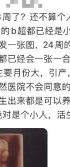 婚外情堕胎后会分手吗_婚外情堕胎_婚外情堕胎影响运气吗